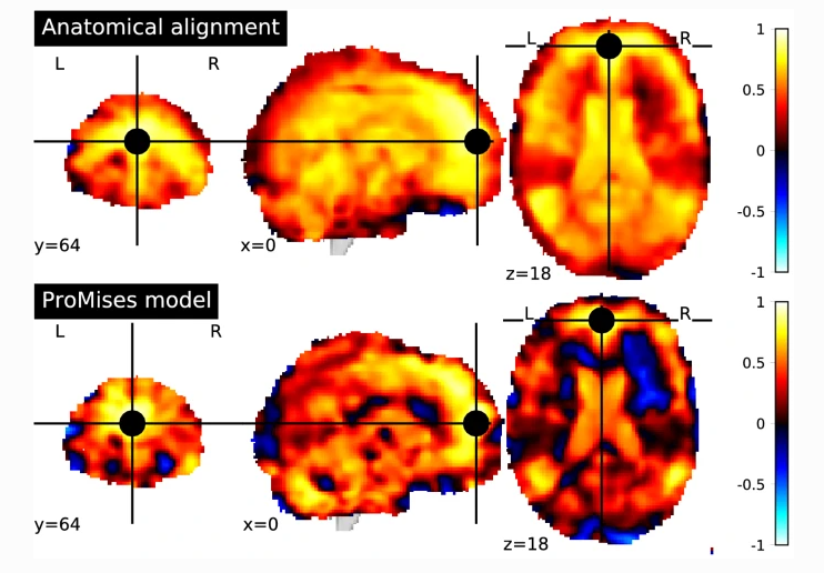 Quality of regularization methods